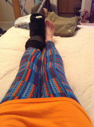 Patricia: Resting After Walking the 5k in the Boot-One Broken Foot